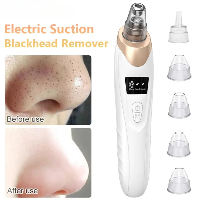 Electric Blackhead Remover – Portable Pore Cleaner-special offer for you
