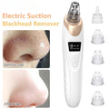 Electric Blackhead Remover – Portable Pore Cleaner-special offer for you